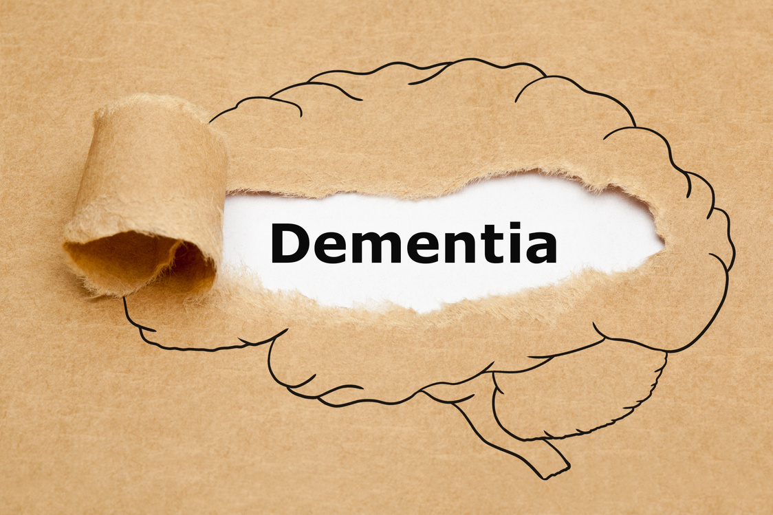 Word Dementia Torn Brown Paper Concept